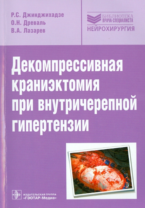 Isbn гэотар медиа. ГЭОТАР Медиа. Декомпрессивная краниэктомия. ГЭОТАР-Медиа Издательство. Геодар.