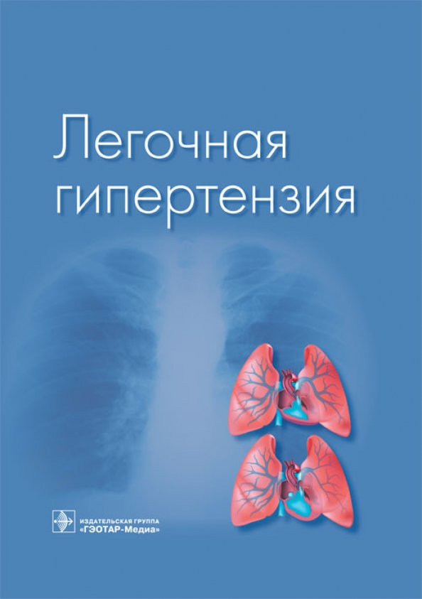 Isbn гэотар медиа. Пульмонолог легочная гипертензия. Легочная гипертензия Чазова. Гипертония учебник. Виктор Пашкин. Легочная гипертензия.