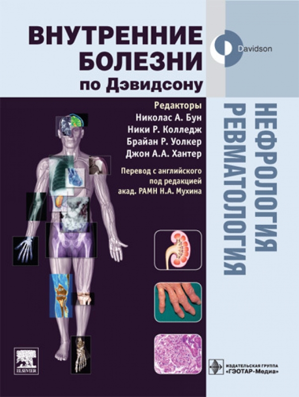 Внутренние болезни том 1. Внутренние болезни по Дэвидсону в 5 томах. Внутренние болезни по Дэвидсону кардиология. Внутренние болезни по Дэвидсону 2 том. Внутренние болезни учебник по Дэвидсону.